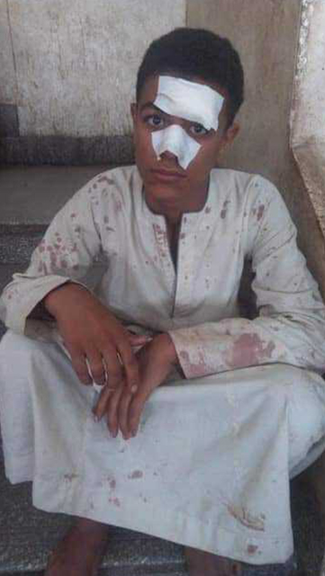 Ishaq, injured